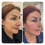 کلینیک زیبایی مهر دخت آتوسا