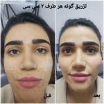 کلینیک زیبایی و لیزر مو گندم شرق تهران