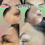 جوانسازی و زیبای فرشته