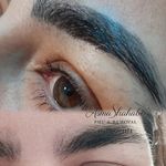 تتو و ریموو تتو درسا