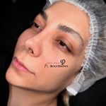 خدمات میکروبلیدینگ آرزو دهقانی بهادور ایلام