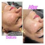 خدمات تخصصی فیشال سارا اسکین بار