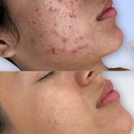 فیشیال / خدمات پوست / سالن زیبایی