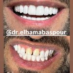 دندانپزشکی و زیبایی دکتر الهام عباسپور