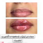 کلینیک پوست و مو و لیزر نیلوفر آبی