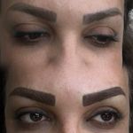 رفع تیرگی لب - اصلاح بدرنگی تتو قدیمی