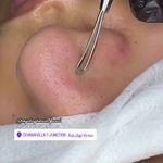 آموزش و خدمات پوست و فیشال رویا باقریان