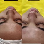 آموزش و خدمات پوست و فیشال رویا باقریان