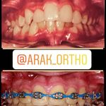 مطب ارتودنسی دکتر آرش محرابی