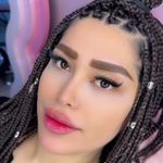 کاشت مژه کیمیا