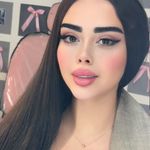 کاشت مژه کیمیا