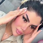 کاشت مژه کیمیا