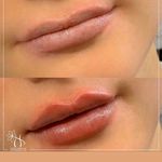 کلینیک پوست و مو و لیزر نیلوفر آبی