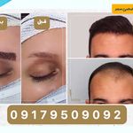 کلینیک تخصصی کاشت مو و زیبایی سمر