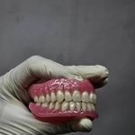 ساخت تخصصی دندان مصنوعی (ایران دنت)