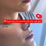 مرکز لیزر و کلینیک زیبایی پریفا