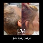 مرکز پوست،مو وزیبایی دکتر فرنوش میلانی