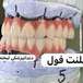 دندانپزشکی لبخند( بیمه نداریم)