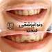 دندانپزشکی لبخند( بیمه نداریم)