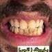 دندانپزشکی لبخند( بیمه نداریم)