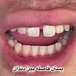 دندانپزشکی لبخند( بیمه نداریم)