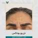 کلینیک تزریق بوتاکس و فیلر نارینا