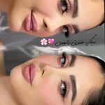 سالن زیبایی ایران درما