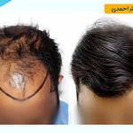 کلینیک فوق تخصصی پوست، مو و زیبایی دکتر راضیه احمدی