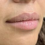 کلینیک زیبایی پوستینو