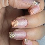 کاشت ناخن الهام در مهرشهر کرج