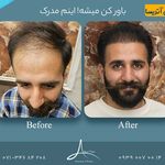 کلینیک زیبایی پوست و مو آتریسا