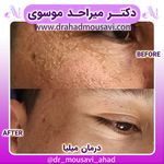 دکترمیراحدموسوی