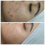 خدمات تخصصی  پوست و زیبایی زینب