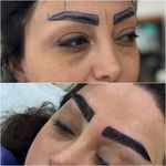 کلینیک زیبایی کاشت مو و ابرو ری رویال