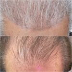 کلینیک زیبایی کاشت مو و ابرو ری رویال