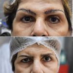 کلینیک زیبایی کاشت مو و ابرو ری رویال