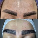 کلینیک زیبایی کاشت مو و ابرو ری رویال