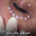 فیشیال پوست آتنا توحیدی