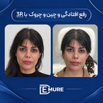 مرکز تخصصی زیبایی و جوانسازی دمور