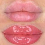 میکروبلیدینگ و میکروپیگمنتیشن نسیم