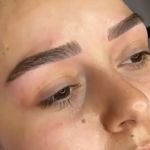 میکروبلیدینگ و میکروپیگمنتیشن نسیم