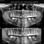 رادیولوژی فک‌ و صورت دکتر مسعود ورشوساز