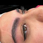 میکروبلیدینگ فیبروز تخصصی
