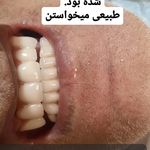 دندانپزشکی ایمپلنت و کلیه خدمات
