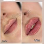 کلینیک زیبایی آذربایجان