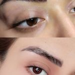 میکروبلدینگ ومیکروپیگمنتیشن حسینی