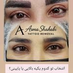 تتو و ریموو تتو درسا