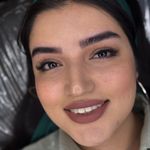 مرکز زیبایی عاطفه ترابی؛ فیبروز ابرو در اصفهان