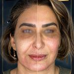 کلینیک تخصصی زیبایی و لیزر موی ابریشم