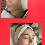 خدمات تخصصی پوست  غریبانی (بل اسکین کر)